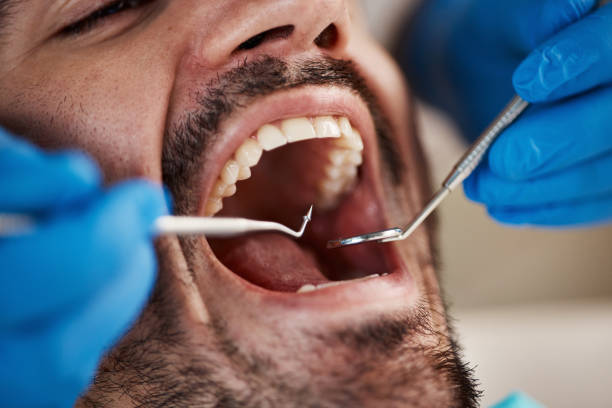 Best Cracked Tooth Emergency Dentist  in Marriott Slaterville, UT